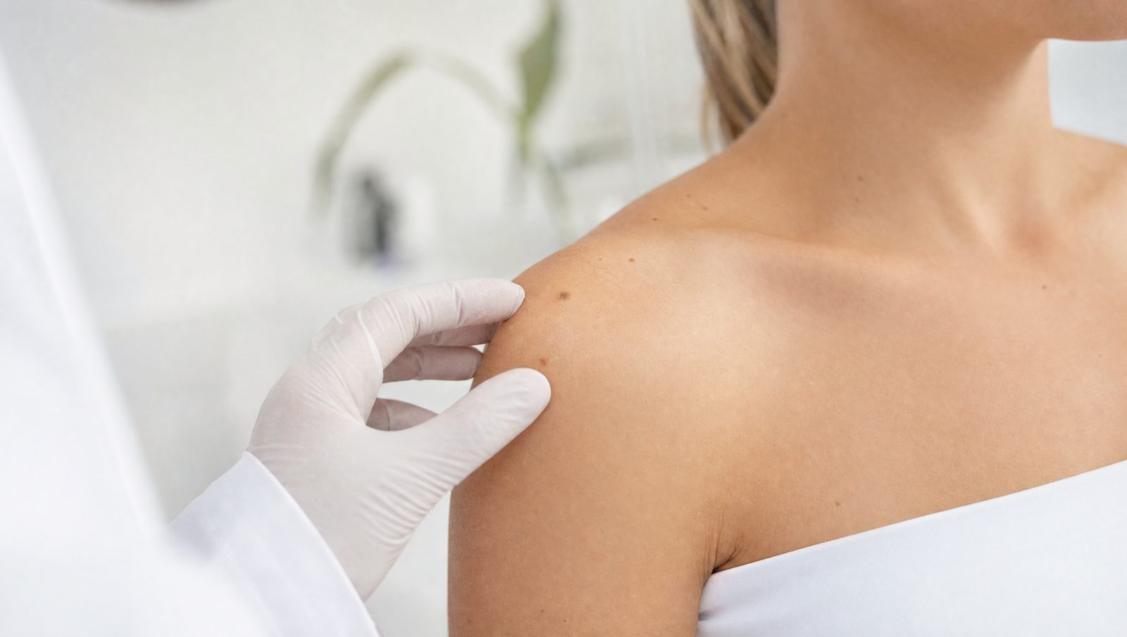Folliculitis