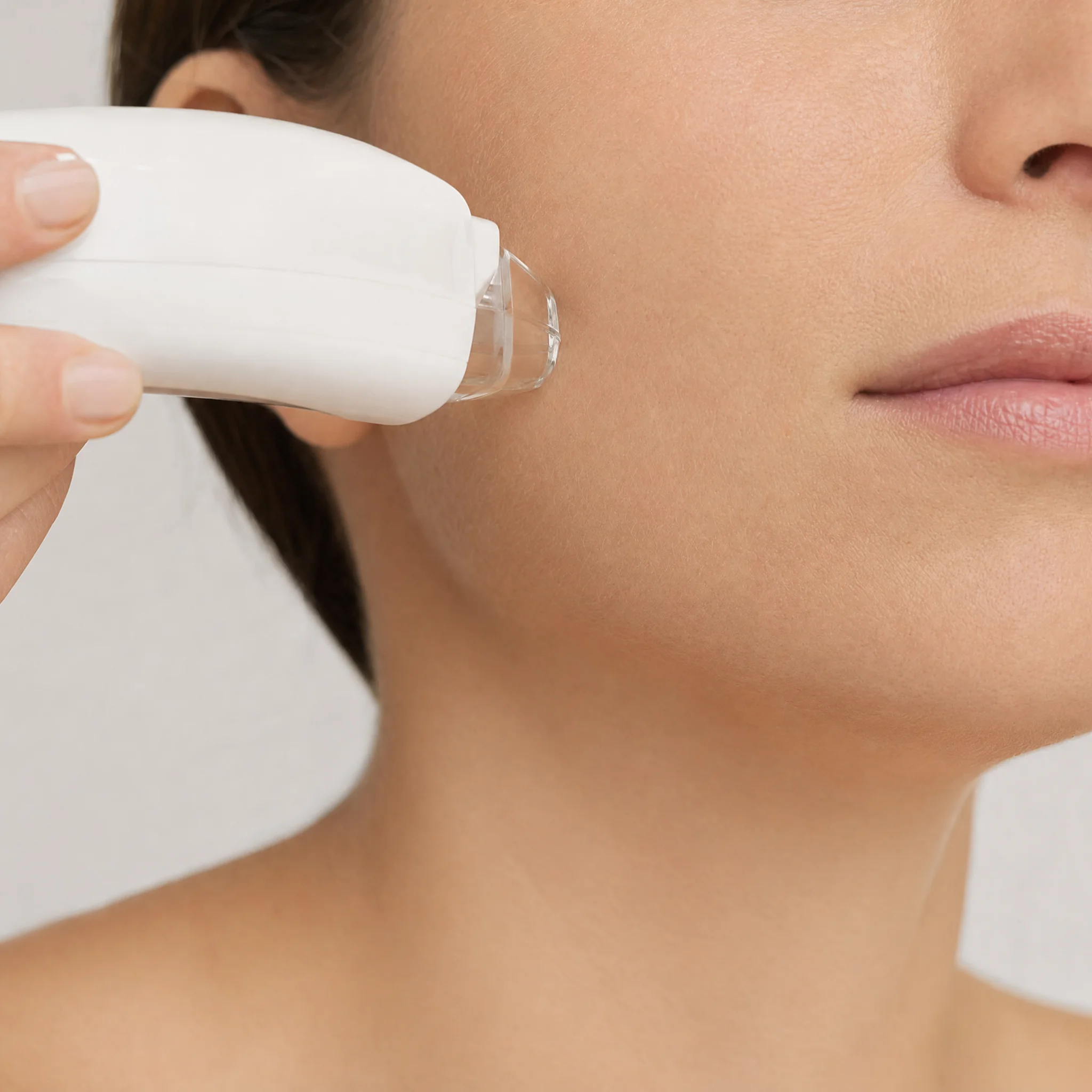 IPL Photofacial