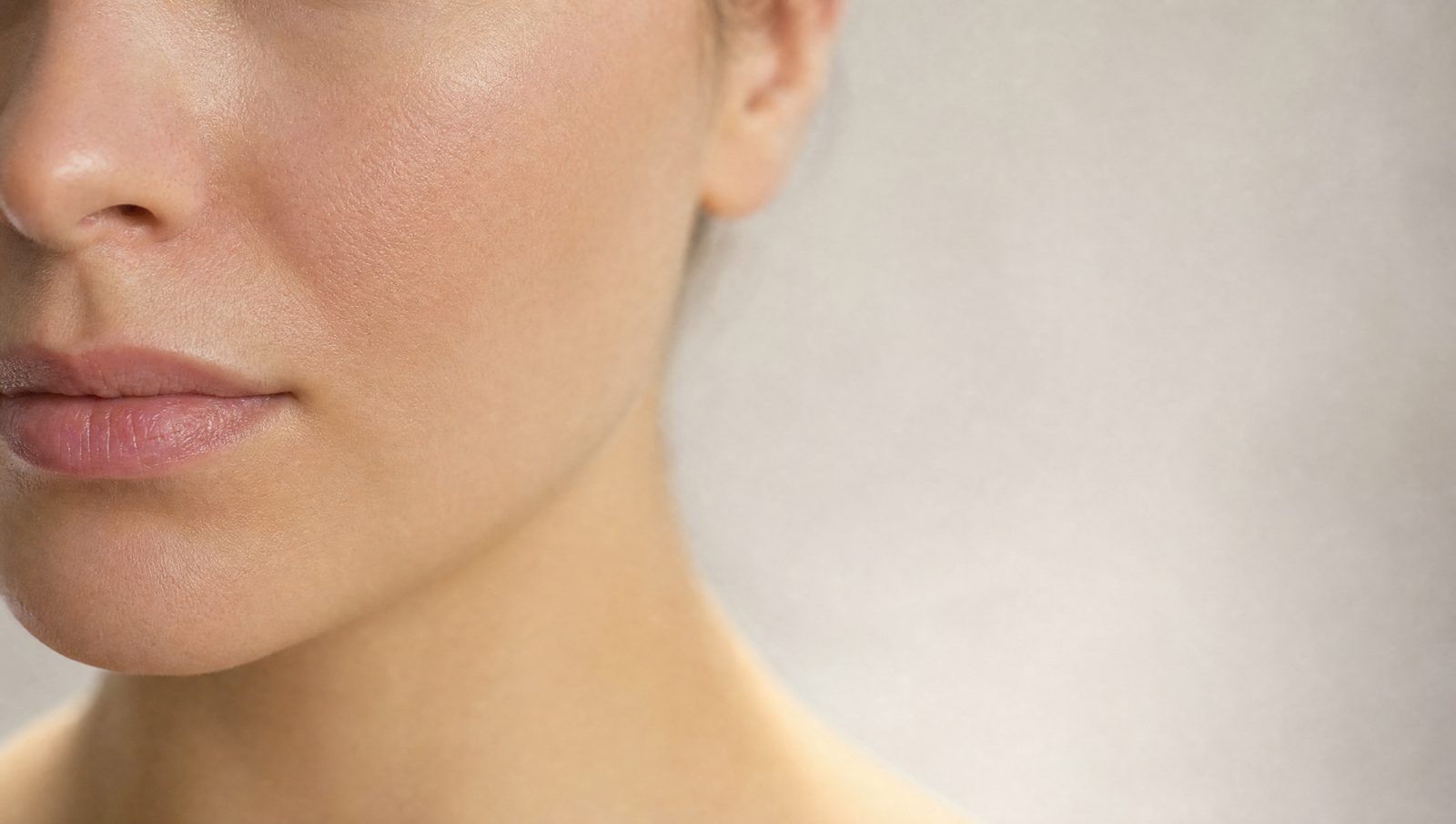 Rosacea