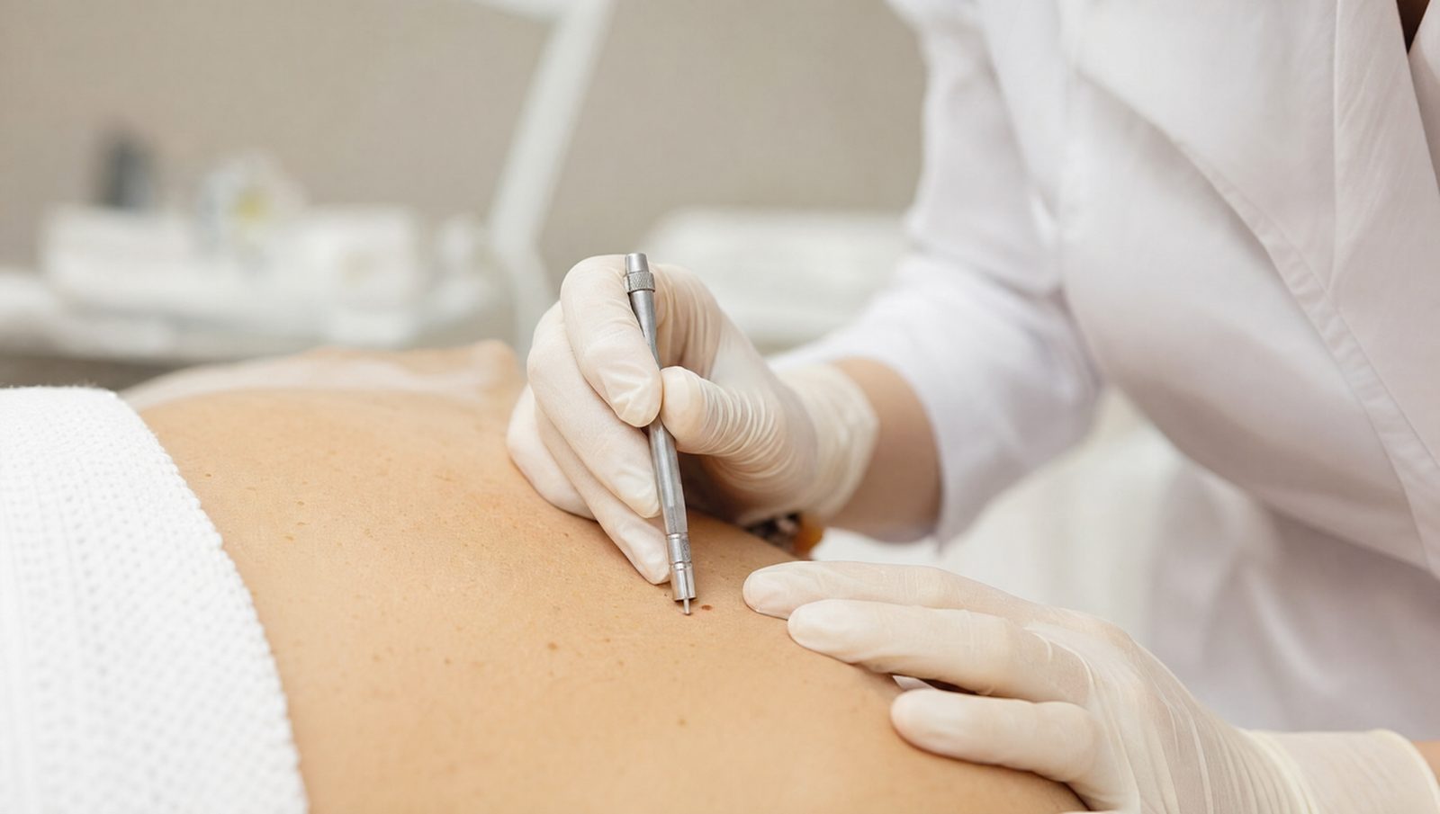 Skin Biopsy