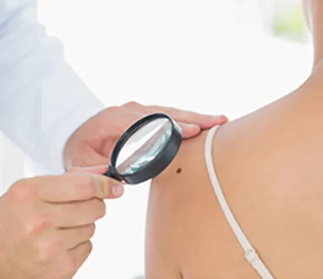 Skin Cancer Testing
